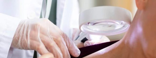 En el país se diagnostican entre siete y ocho pacientes con cáncer de piel cada día
